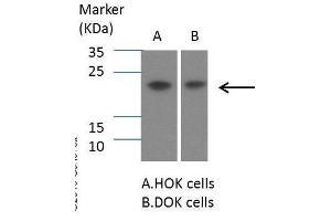 WB Image Sample (30 ug of whole cell lysate) A: Hep G2 , 12% SDS PAGE antibody diluted at 1:1000 (SOCS1 抗体  (C-Term))
