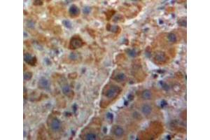 Used in DAB staining on fromalin fixed paraffin-embedded Liver tissue (PLG 抗体  (AA 582-812))