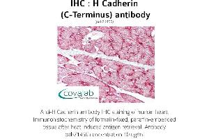 Image no. 1 for anti-Cadherin 13 (CDH13) (C-Term) antibody (ABIN5693589) (Cadherin 13 抗体  (C-Term))