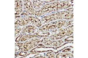 Immunohistochemistry of paraffin-embedded rat liver using [KO Validated] Heme Oxygenase 1 (HO-1/HMOX1) Rabbit pAb (ABIN6131781, ABIN6141881, ABIN6141883 and ABIN6215065) at dilution of 1:50 (40x lens). (HMOX1 抗体  (AA 1-288))