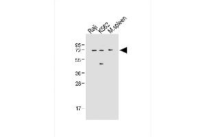 All lanes : Anti-IRAK3 Antibody (N-term) at 1:500 dilution Lane 1: Raji whole cell lysate Lane 2: K562 whole cell lysate Lane 3: Mouse spleen tissue lysate Lysates/proteins at 20 μg per lane. (IRAK3 抗体  (N-Term))