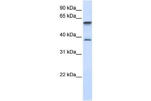 WB Suggested Anti-GIMAP5 Antibody Titration:  0.