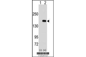 Western blot analysis of PUM2 using rabbit polyclonal PUM2 Antibody using 293 cell lysates (2 ug/lane) either nontransfected (Lane 1) or transiently transfected with the PUM2 gene (Lane 2).