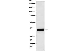 Western blot analysis of PRKRA expression in HepG2 cell lysate.