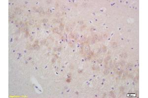 Formalin-fixed and paraffin embedded rat brain labeled with Rabbit Anti gamma Synuclein Polyclonal Antibody, Unconjugated (ABIN671001) at 1:200 followed by conjugation to the secondary antibody and DAB staining (SNCG 抗体  (AA 2-123))