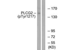 Western blot analysis of extracts from Jurkat cells treated with UV 15', using PLCG2 (Phospho-Tyr1217) Antibody. (Phospholipase C gamma 2 抗体  (pTyr1217))