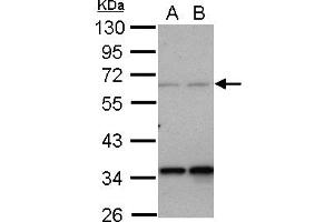 Western Blotting (WB) image for anti-Protein Phosphatase 4, Regulatory Subunit 2 (PPP4R2) (AA 1-360) antibody (ABIN1500387) (PPP4R2 抗体  (AA 1-360))