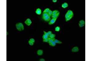 Immunofluorescence staining of HepG2 cells with ABIN7162391 at 1:100, counter-stained with DAPI. (CPOX 抗体  (AA 19-149))
