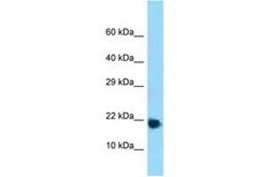 Image no. 1 for anti-Ribosomal Protein L32 (RPL32) (AA 61-110) antibody (ABIN6748313) (RPL32 抗体  (AA 61-110))
