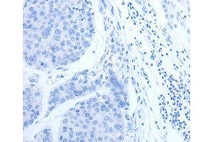 Immunohistochemistry (IHC) image for anti-Complement Factor H-Related 1 (CFHR1) antibody (ABIN1871806) (CFHR1 抗体)