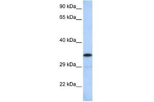 KCTD4 antibody used at 1 ug/ml to detect target protein. (KCTD4 抗体  (Middle Region))