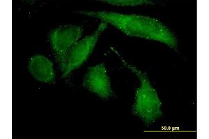 Immunofluorescence of monoclonal antibody to ROCK2 on HeLa cell. (ROCK2 抗体  (AA 1279-1388))