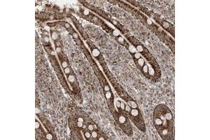 Immunohistochemical staining of human duodenum with NDUFAF3 polyclonal antibody  shows strong granular cytoplasmic positivity in glandular cells. (NDUFAF3 抗体)