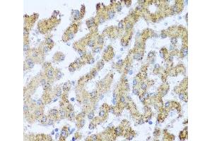 Immunohistochemistry of paraffin-embedded Human liver using MOK Polyclonal Antibody at dilution of 1:100 (40x lens). (MOK 抗体)