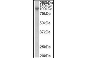 Image no. 1 for anti-ADAM Metallopeptidase Domain 8 (ADAM8) (C-Term) antibody (ABIN374195) (ADAM8 抗体  (C-Term))
