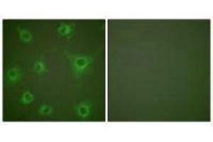 Immunofluorescence analysis of COS7 cells, using Collagen II antibody. (COL2A1 抗体)