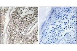 Immunohistochemistry analysis of paraffin-embedded human testis tissue, using RAB3GAP1 Antibody. (RAB3GAP1 抗体  (AA 538-587))