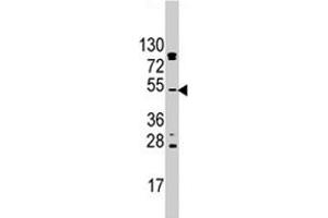 Western blot analysis of AKT2 polyclonal antibody  in mouse liver tissue lysates (35 ug/lane). (AKT2 抗体  (N-Term))
