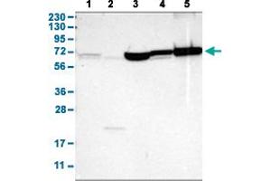 Western Blot analysis with SHOC2 polyclonal antibody . (SHoc2/Sur8 抗体  (AA 455-562))
