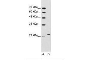 Image no. 2 for anti-BCL2-Associated Athanogene 2 (BAG2) (C-Term) antibody (ABIN203503) (BAG2 抗体  (C-Term))