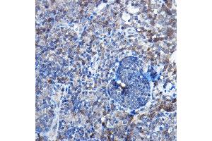 Immunohistochemistry of paraffin-embedded rat lymph node using Bax Rabbit mAb  at dilution of 1:25,1:50 (40x lens). (BAX 抗体)