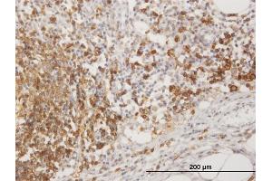 Immunoperoxidase of purified MaxPab antibody to MS4A1 on formalin-fixed paraffin-embedded human lymph node.