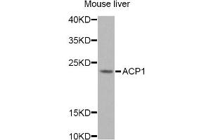 Western blot analysis of extracts of mouse liver, using ACP1 Antibody. (ACP1 抗体)