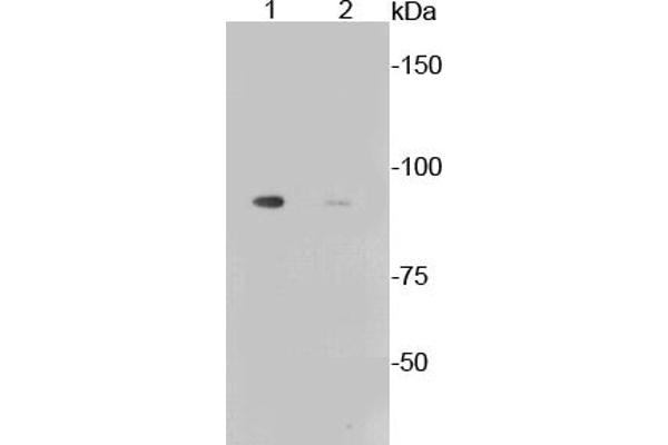 Glycogen Synthase 1 抗体  (pSer641)