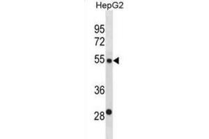 Western Blotting (WB) image for anti-ST6 beta-Galactosamide alpha-2,6-Sialyltranferase 2 (ST6GAL2) antibody (ABIN3000959) (ST6GAL2 抗体)
