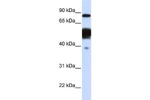 WB Suggested Anti-NEXN Antibody Titration:  0. (NEXN 抗体  (Middle Region))