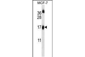 Western blot analysis in MCF-7 cell line lysates (35ug/lane). (UBE2W 抗体  (C-Term))