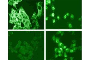 Immunofluorescence staining for p38 MAPK (pT180/pY182) (right figure). (MAPK14 抗体  (pThr180))