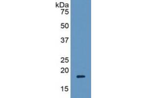 WB of Protein Standard: different control antibodies against Highly purified E. (Periostin ELISA 试剂盒)