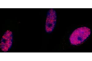 Immunofluorescence (IF) image for anti-Structural Maintenance of Chromosomes 1A (SMC1A) (pSer966) antibody (ABIN7455211) (SMC1A 抗体  (pSer966))