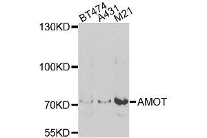 Western blot analysis of extracts of various cells, using AMOT antibody.