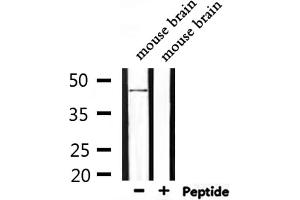 Western blot analysis of extracts from mouse brain, using NMUR1 Antibody. (NMUR1 抗体  (N-Term))