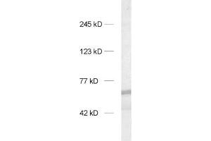 dilution: 1 : 1000, sample: rat brain homogenate (INA 抗体)