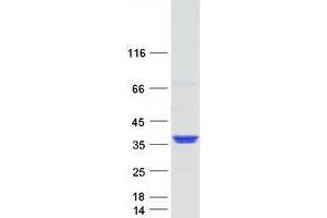 Validation with Western Blot