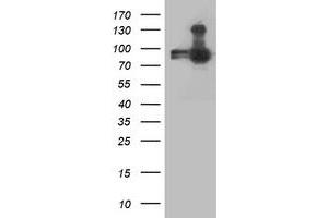 Western Blotting (WB) image for anti-Anaphase Promoting Complex Subunit 2 (ANAPC2) antibody (ABIN1496638) (ANAPC2 抗体)