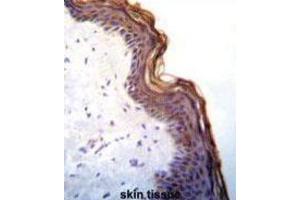 Immunohistochemistry (IHC) image for anti-Kallikrein 7 (KLK7) antibody (ABIN3002618) (Kallikrein 7 抗体)