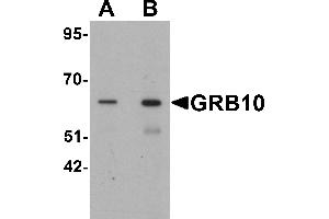 Western blot analysis of GRB10 in SK-N-SH cell lysate with GRB10 antibody at (A) 1 and (B) 2 µg/mL. (GRB10 抗体  (C-Term))