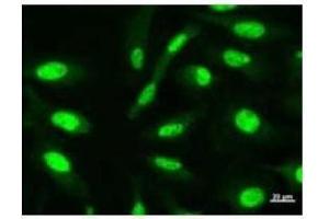 Immunostaining analysis in HeLa cells. (CHD6 抗体)