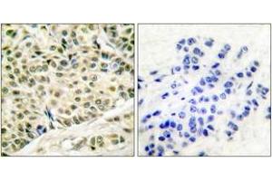 Immunohistochemistry (IHC) image for anti-Minichromosome Maintenance Complex Component 2 (MCM2) (AA 1-50) antibody (ABIN1533339)