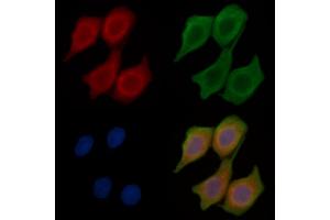 ABIN6259817 and ABIN6268680 staining Hela cells(45 min of heat-shock treatment) by IF/ICC. (alpha Fetoprotein 抗体  (C-Term))