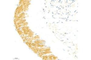 Immunohistochemistry of paraffin embedded mouse lung using collagen alpha-1 (V) (ABIN7073547) at dilution of 1: 1800 (400x lens)