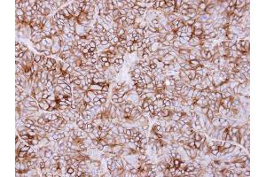 IHC-P Image Immunohistochemical analysis of paraffin-embedded SW480 xenograft, using KIDINS220, antibody at 1:500 dilution. (KIDINS220 抗体  (C-Term))