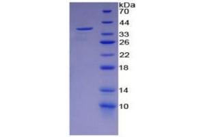 SDS-PAGE of Protein Standard from the Kit  (Highly purified E. (ENO2/NSE ELISA 试剂盒)