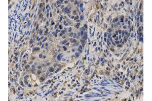 Immunohistochemistry (IHC) image for anti-Calcium/calmodulin-Dependent serine Protein Kinase (MAGUK Family) (CASK) antibody (ABIN1871447) (CASK 抗体)