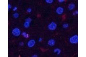 Immunofluorescence analysis of Rat liver tissue using Phospho-Pan-Akt (Ser473) Polyclonal Antibody at dilution of 1:200 (AKT1 抗体  (pSer473))