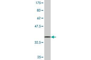 Western Blot detection against Immunogen (36. (Oncostatin M Receptor 抗体  (AA 141-240))
